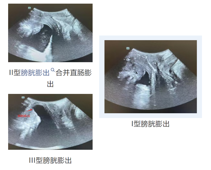 ecd4d3c2ef60e55259cfe6b76961bbaf