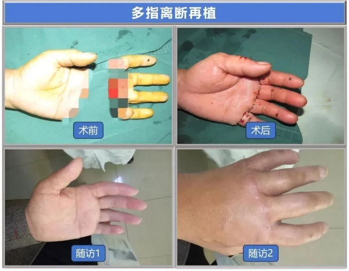 17f5c848f71405eb1f29dd2003265491