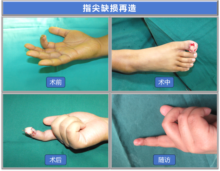 0ca2b9afbfb6fd26c196893e4e9ba1b1