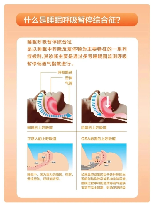 64cbebb99b50b5a71ed356112b9f427c