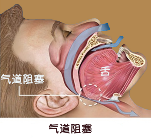 86f457fb6559cfaec28caac172a197a2