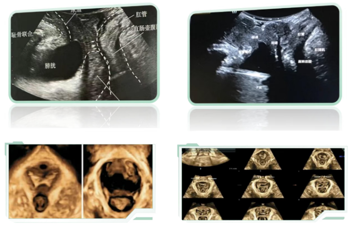 516f1181cc16d6aece2b92175aaf822c