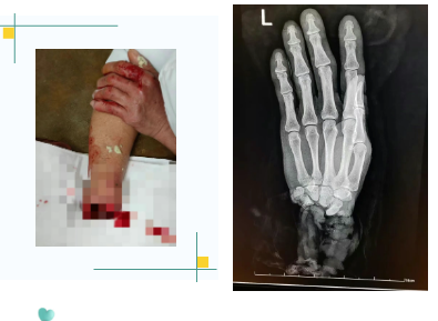 63542247c928d395ae3da60582d9a5d5