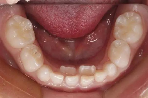 ca35c48e9af17a96e38f4d3bec1eeb09