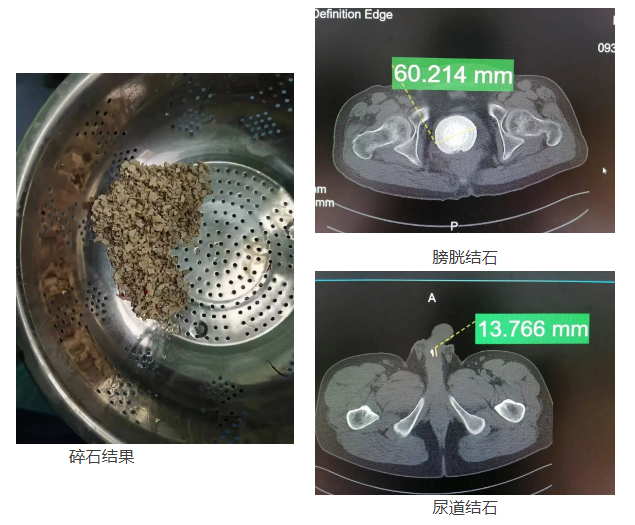 81e76e2f7df6be5d4bf688552bbeac1a