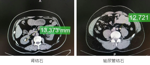 42ff93ec571f86b710b1d4742d87eeb0