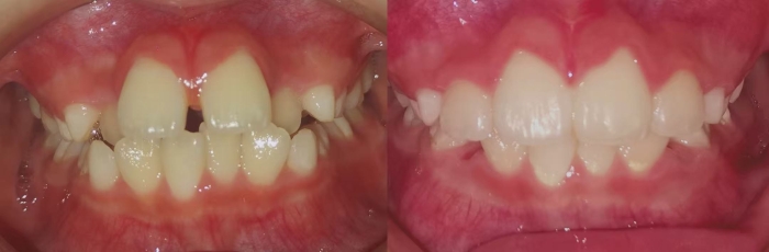 2e357d4587331f23f748a63419f6f21f