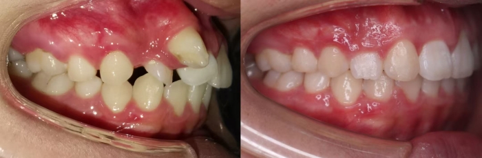 16547f50eea9672fe0463ba0f05e8dfa